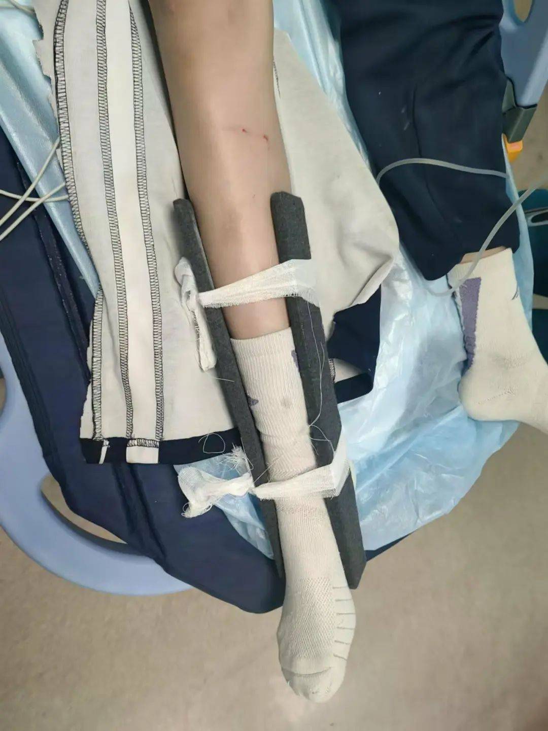 惨痛<strong></p>
<p>如何买股票新手入门</strong>！一人身亡！深圳多名学生骑电动车发生意外