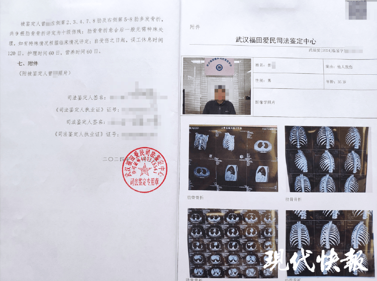 湖北一男子称被交警打断9根肋骨未立案<strong></p>
<p>脑白金</strong>，警方回应