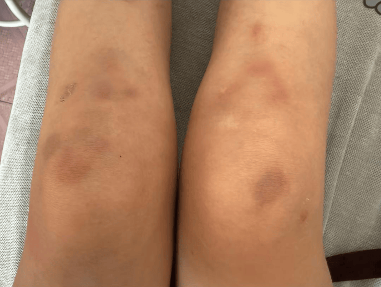 女子自称因工资问题被老板锁办公室里打 警方：双方已到派出所<strong></p>
<p>加密数字货币</strong>，是否打人还在调查