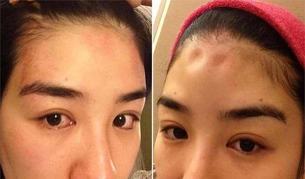 罗霖被家暴17年<strong></p>
<p>加密数字货币</strong>，蓝洁瑛遭性侵暴力还被围观！女明星的暴力事件还有很多