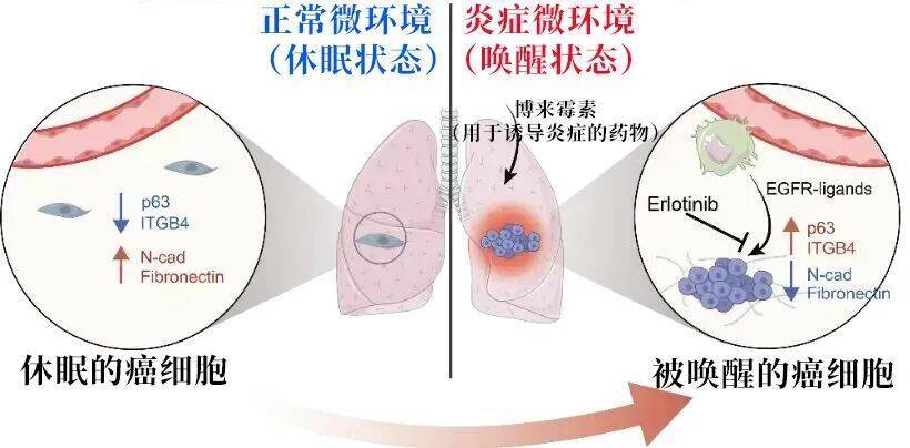 长期炎症会“唤醒”癌细胞<strong></p>
<p>加密货币</strong>！这份抗炎指南每个人都该看看