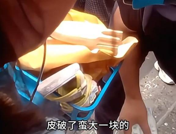 看着都疼<strong></p>
<p>瑞波币今日行情</strong>！上海街头一男子突然求助：10岁女儿被死死卡住！这个行为太危险→