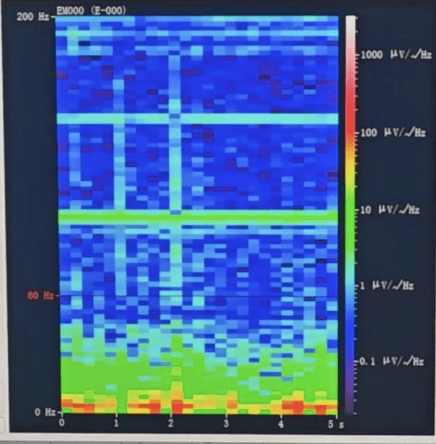 山西首例<strong></p>
<p>泰达币</strong>!山西省人民医院成功实施脑机接口辅助功能区脑肿瘤切除手术