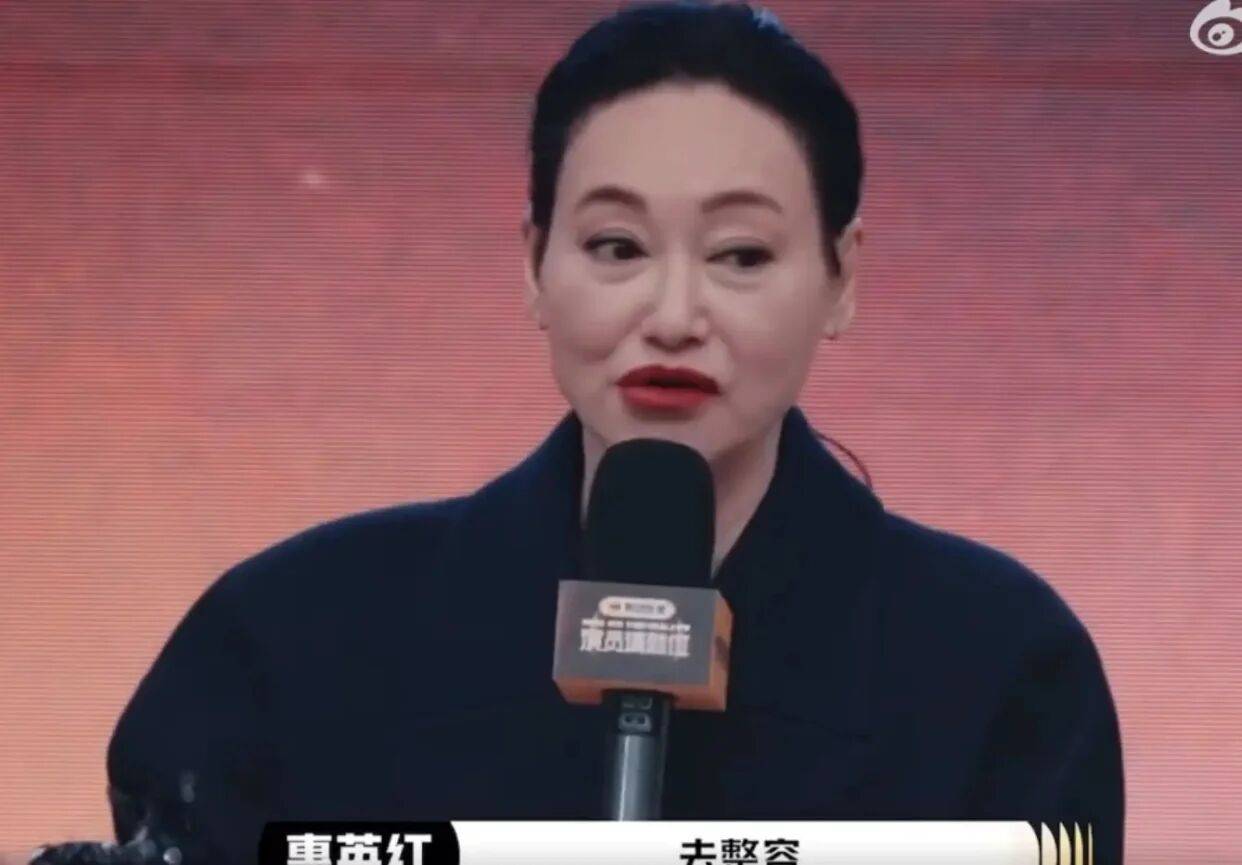 考古|惠英红自曝拿奖后谈百倍涨薪!拍打戏至残疾阑尾手术后7天复工<strong></p>
<p>binance</strong>,她的人生是拼出来的