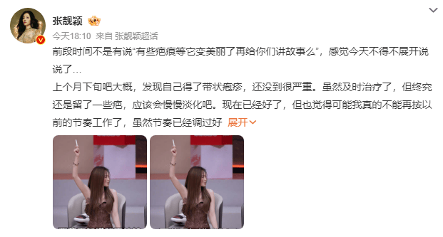 张靓颖发长文谈身体状况<strong></p>
<p>binance平台</strong>,自曝得带状疱疹、旧伤复发,取消跨年演唱会加场计划